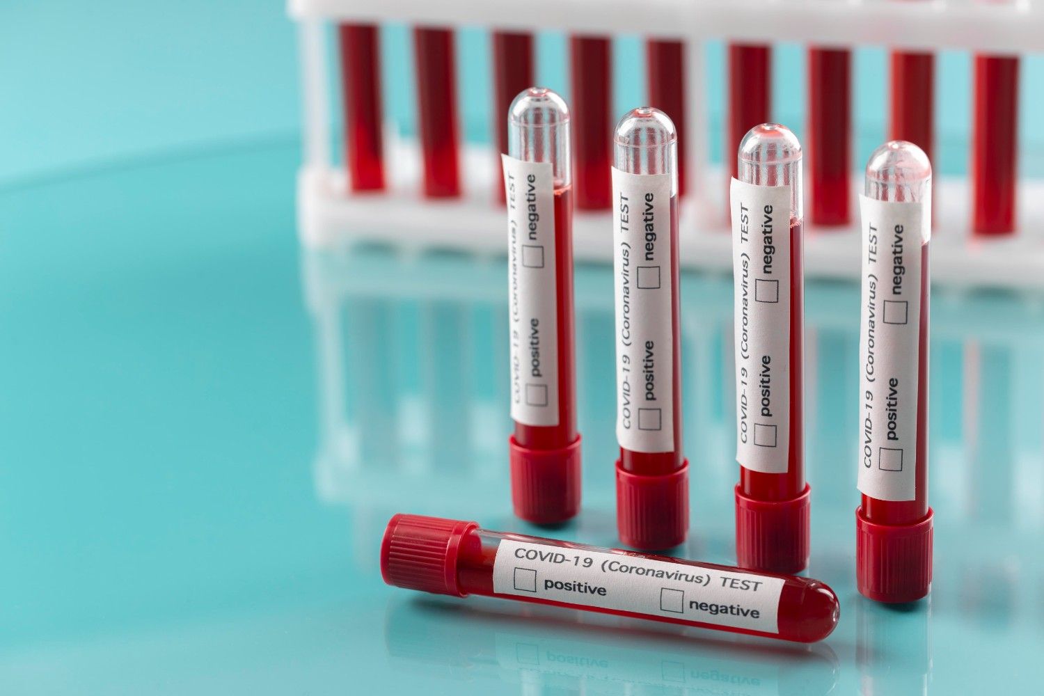 Blood Tests